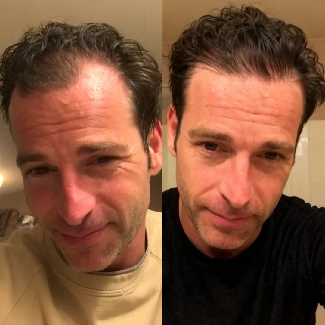 Before and After Results 2