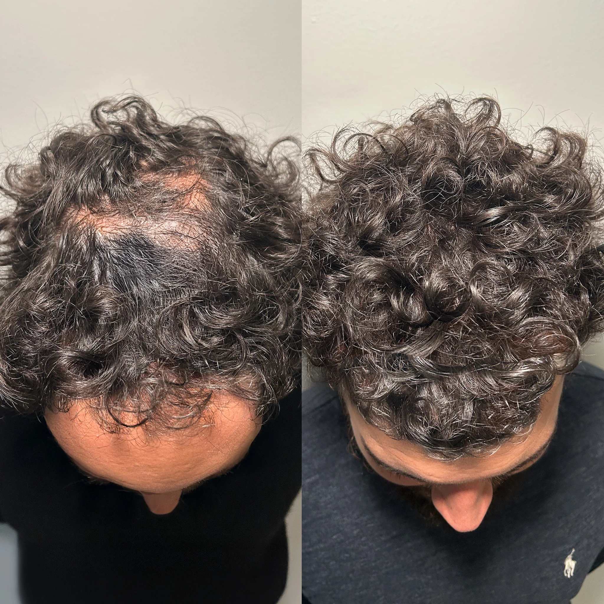 Before and After Results 1